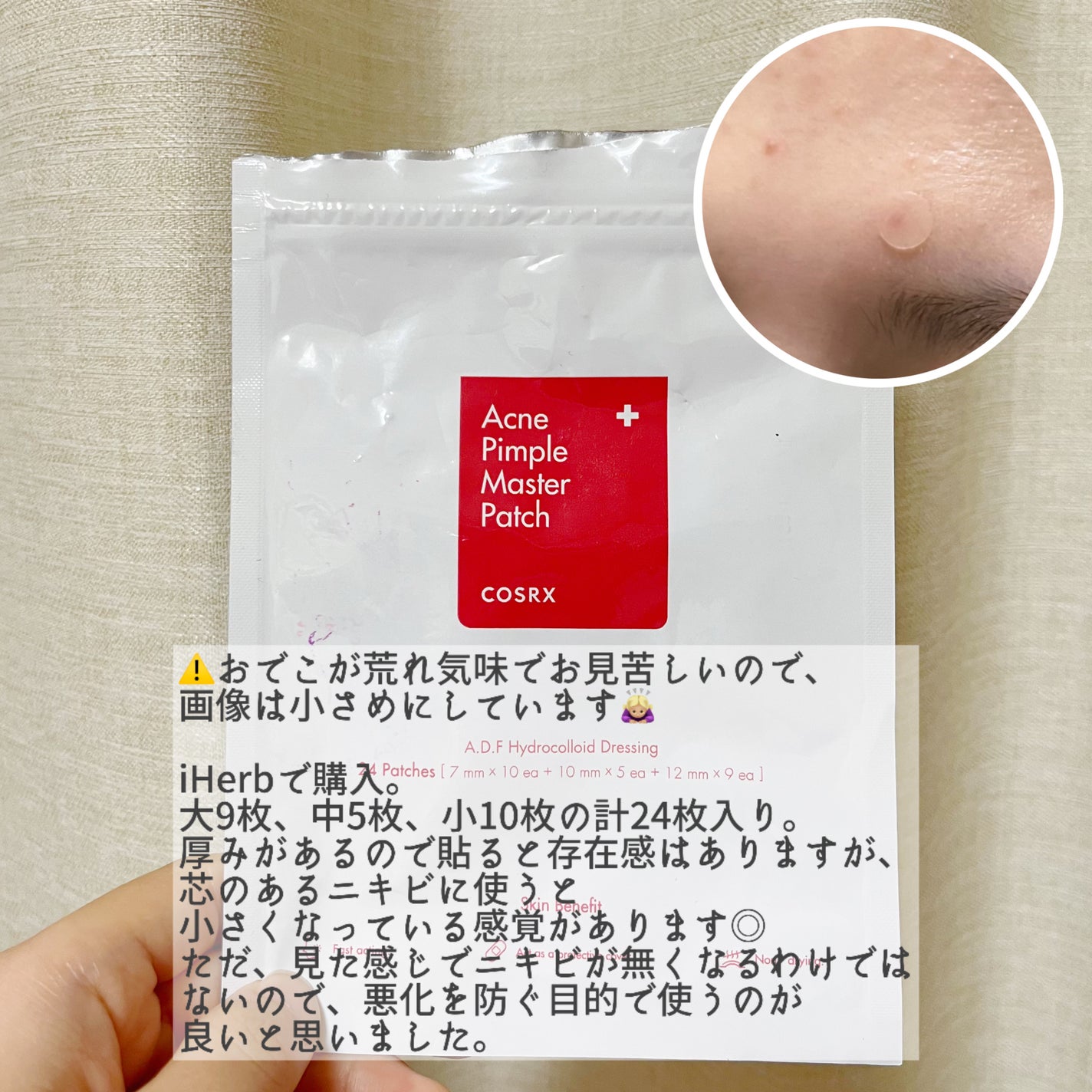 アクネピンプルマスターパッチ /COSRX/にきびパッチを使ったクチコミ(2枚目)