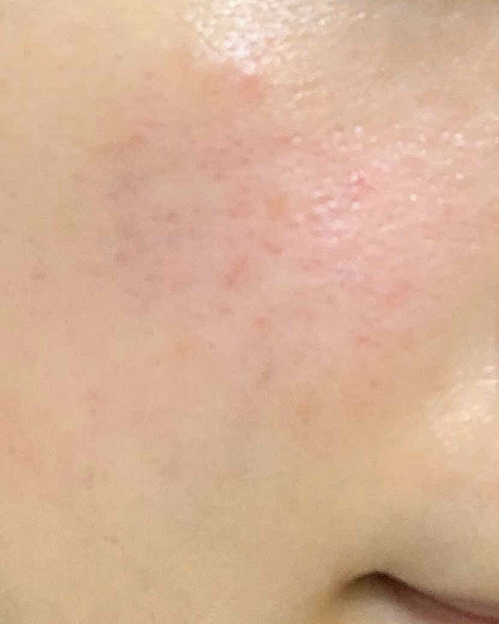 モイスチャーACEオイル/エンビロン/フェイスオイルを使ったクチコミ（2枚目）