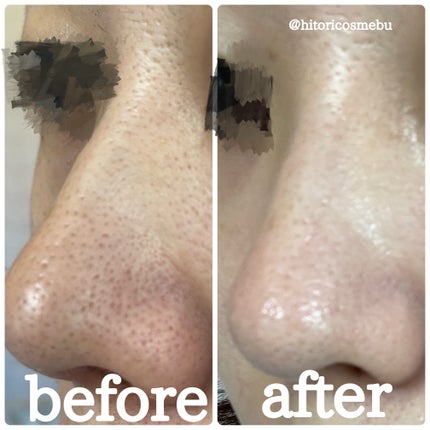 ディープクリーンマスター/ilso/その他スキンケアグッズを使ったクチコミ(1枚目)