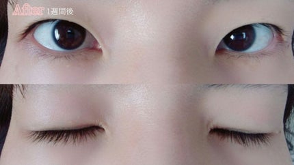 アイラッシュセラム/ルジュ/まつげ美容液を使ったクチコミ(7枚目)