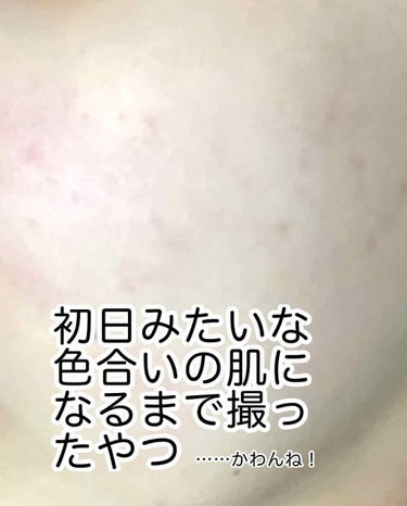 桜雪の雫。/Shiro no Sakura./美容サプリメントを使ったクチコミ（4枚目）