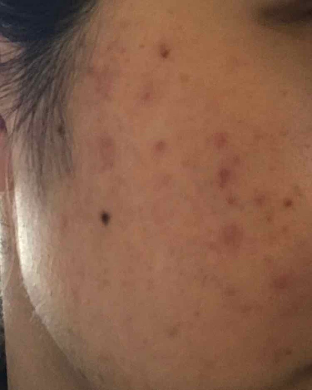 皮脂トラブルケア 化粧水/キュレル/化粧水を使ったクチコミ（3枚目）