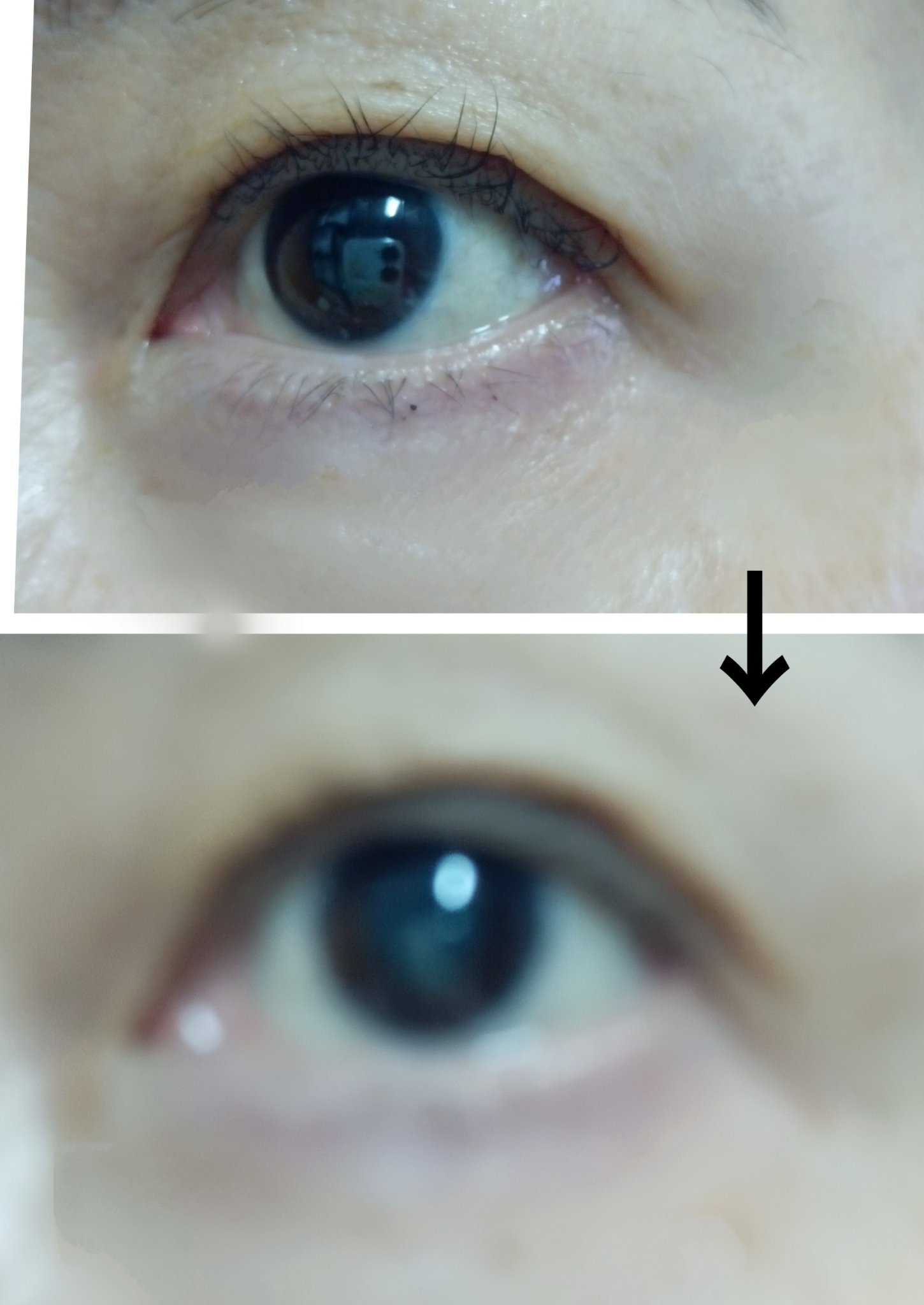 リッドキララ/北の快適工房/アイケア・アイクリームを使ったクチコミ（2枚目）