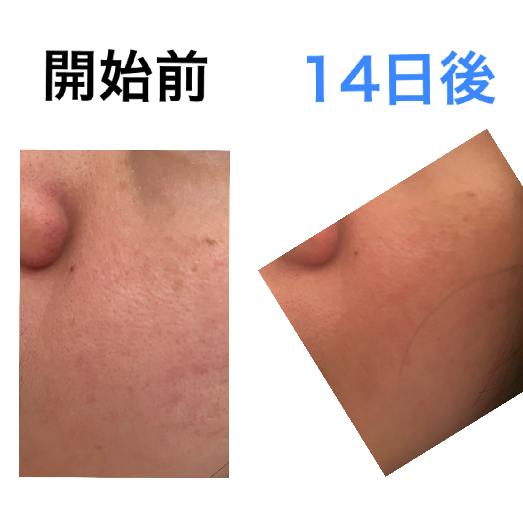 キューブマスク レチノール/ネイチャーリパブリック/シートマスク・パックを使ったクチコミ（3枚目）