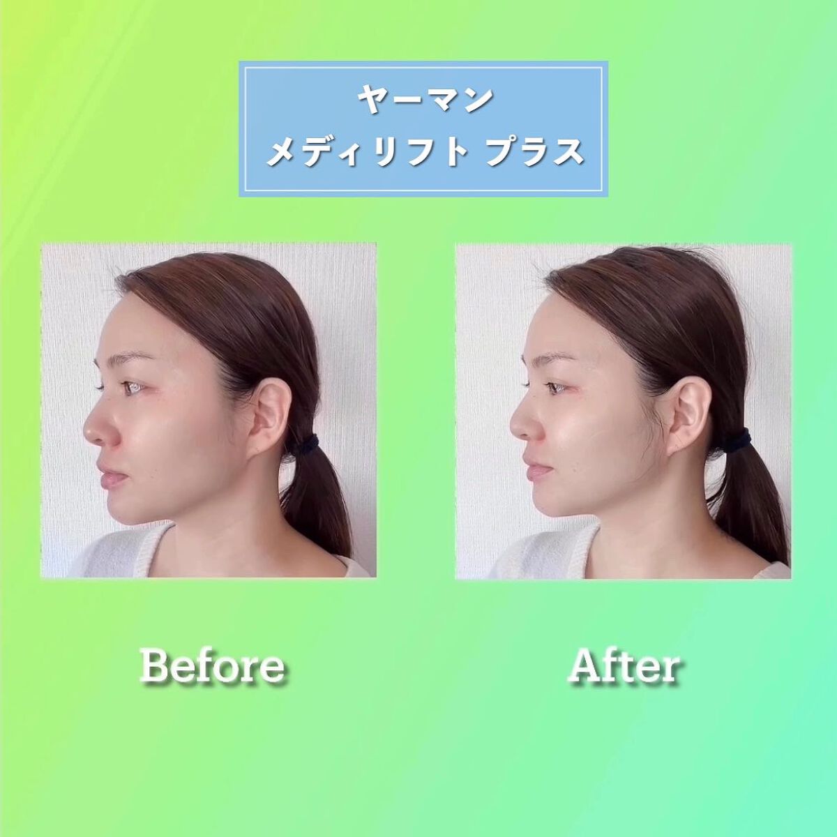 メディリフト /YA-MAN TOKYO JAPAN/美顔器・マッサージを使ったクチコミ(8枚目)