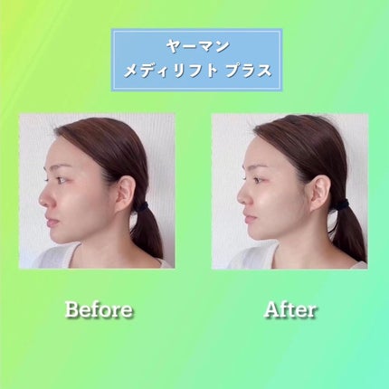 メディリフト /YA-MAN TOKYO JAPAN/美顔器・マッサージを使ったクチコミ(8枚目)