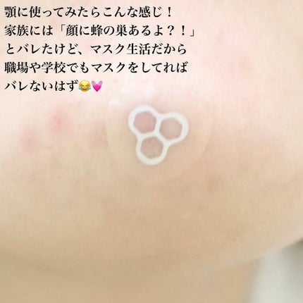 ACマグネシウムパッチ ミニ/スノーツープラス/にきびパッチを使ったクチコミ(5枚目)