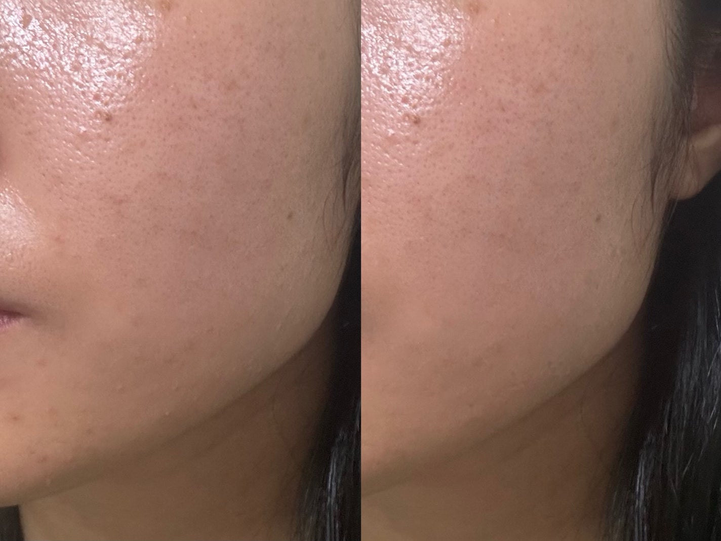 シカリニック HA バイオ エッセンス/CICALINIC/美容液を使ったクチコミ(3枚目)