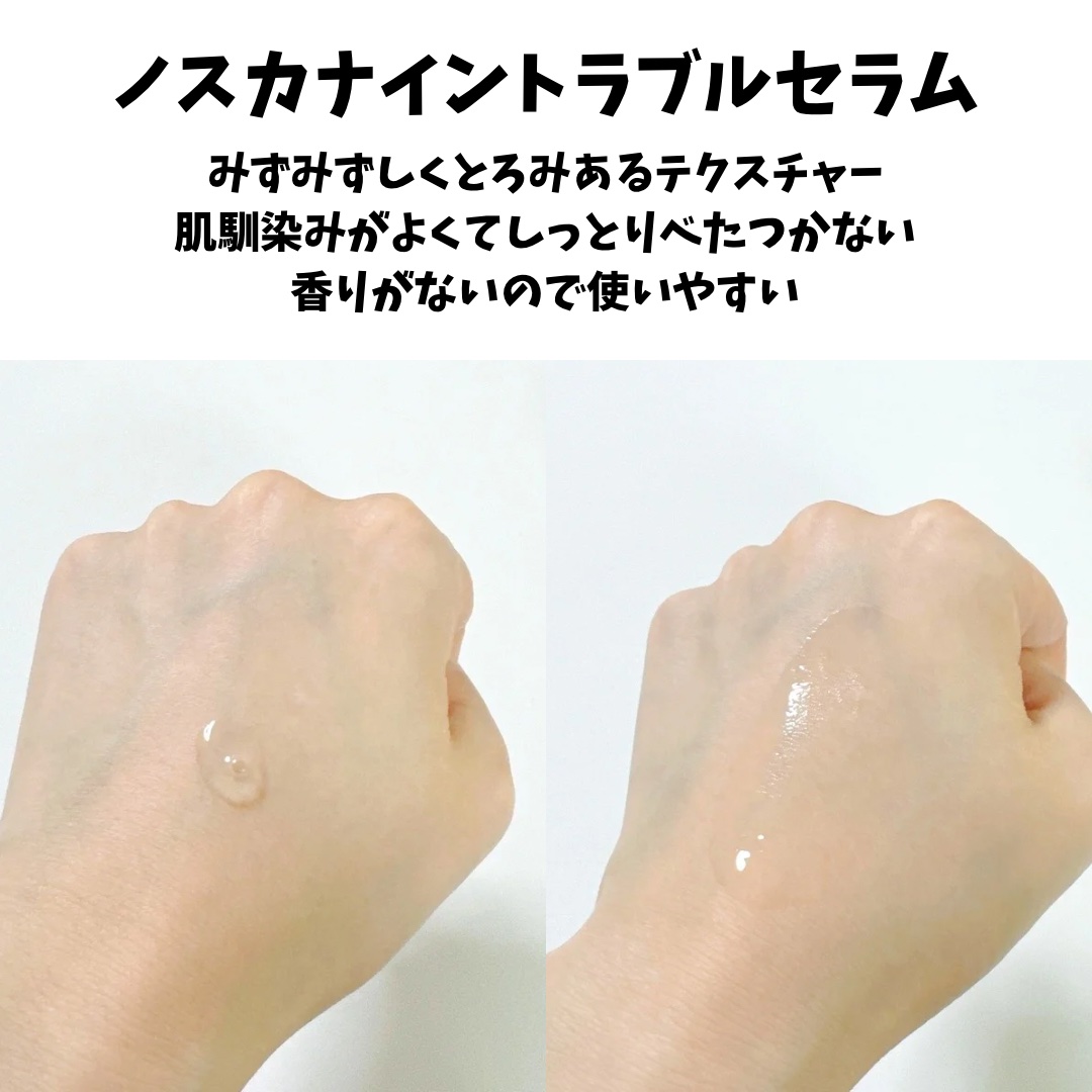 ノスカナインTクリームS/FATION/フェイスクリームを使ったクチコミ（3枚目）