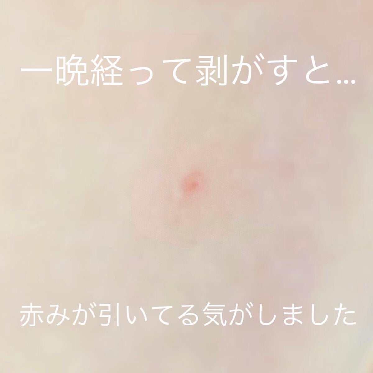 ã»ããŠðãã©ãã(æçš¿ããæ¹) on LIPS ããããè·¡ãããã¿ãæ°ã«ãªãç®æã«å¯ãåã«è²Œããã£ãŒããã¿Cãã..ãïŒ5æç®ïŒ