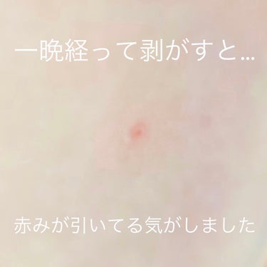 ほたて🐚フォロバ(投稿ある方) on LIPS 「ニキビ跡やくすみが気になる箇所に寝る前に貼るディープビタCパッ..」（5枚目）