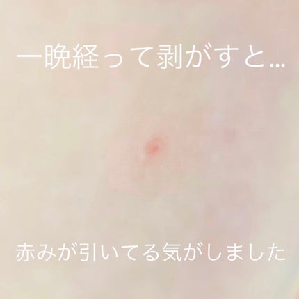 ã»ããŠðãã©ãã(æçš¿ããæ¹) on LIPS ããããè·¡ãããã¿ãæ°ã«ãªãç®æã«å¯ãåã«è²Œããã£ãŒããã¿Cãã..ãïŒ5æç®ïŒ