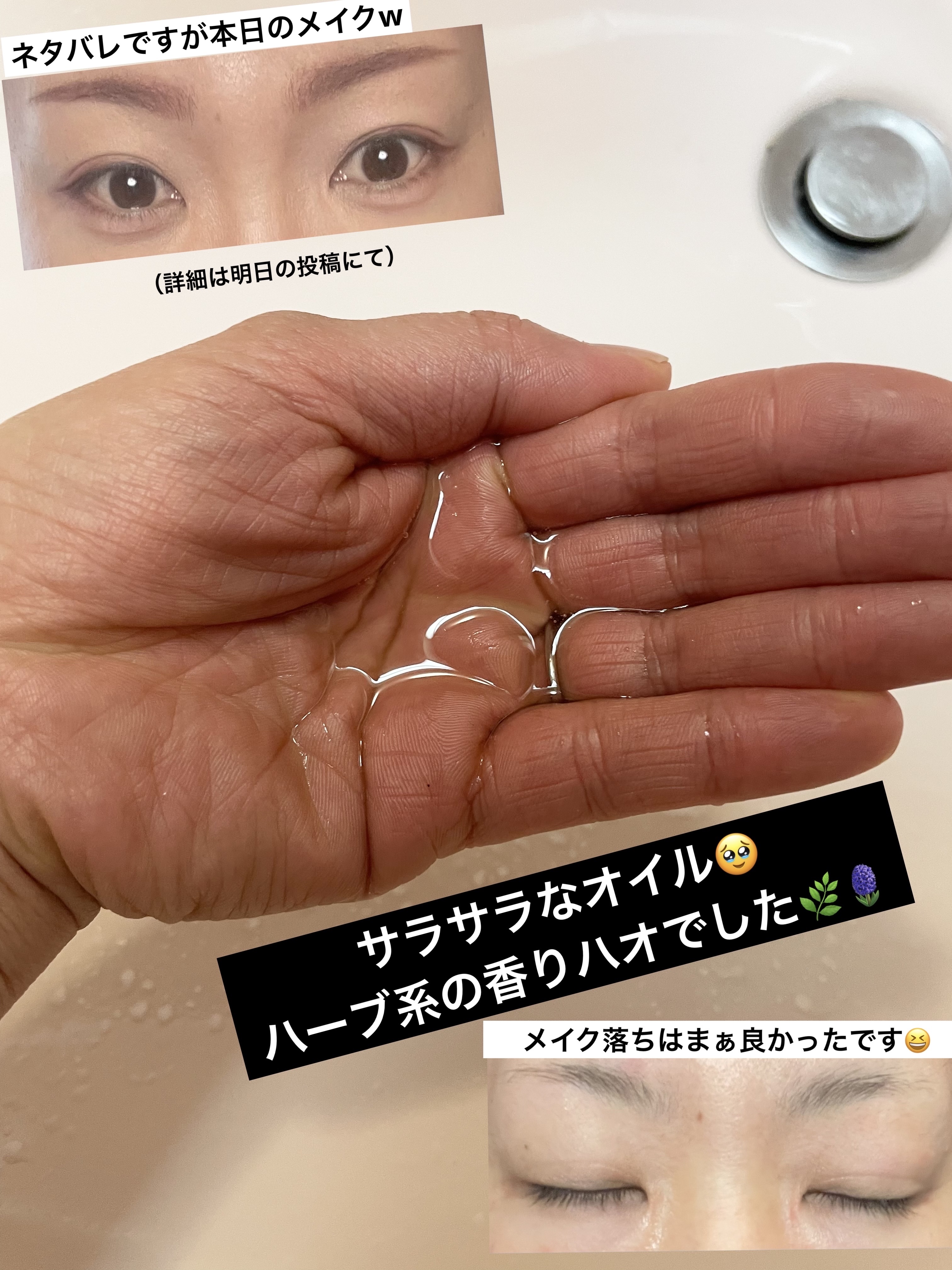 CHOIクレンジングオイル 薬用ニキビケア 本体（150ml）/肌美精/オイルクレンジングを使ったクチコミ（2枚目）