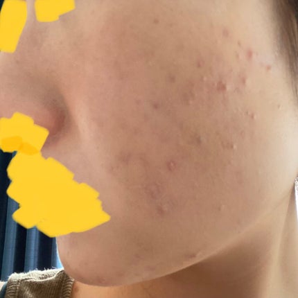 24 ミネラルスティックファンデ/24h cosme/その他ファンデーションを使ったクチコミ(4枚目)