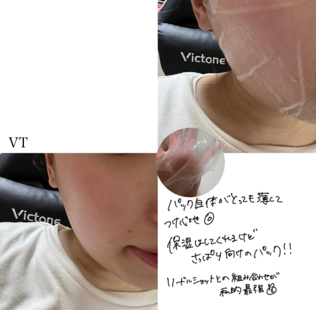 ダーマレーザースーパーVC100マスク/クオリティファースト/シートマスク・パックを使ったクチコミ(9枚目)