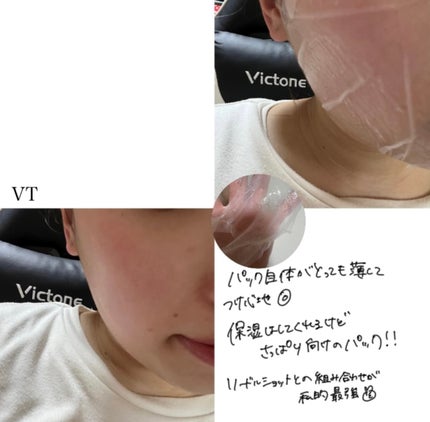 ダーマレーザースーパーVC100マスク/クオリティファースト/シートマスク・パックを使ったクチコミ(9枚目)