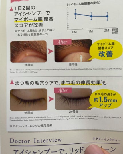 アイシャンプーロング/メディプロダクト/その他洗顔料を使ったクチコミ(2枚目)