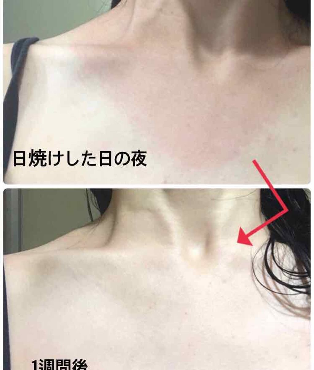 ハトムギ化粧水(ナチュリエ スキンコンディショナー R )/ナチュリエ/化粧水を使ったクチコミ(3枚目)