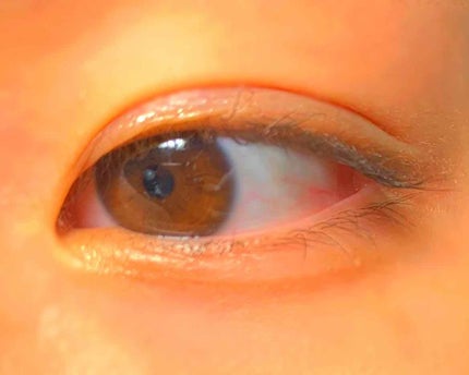 【旧品】オリシキ アイリッドスキンフィルム/D-UP/二重まぶた用アイテムを使ったクチコミ(2枚目)