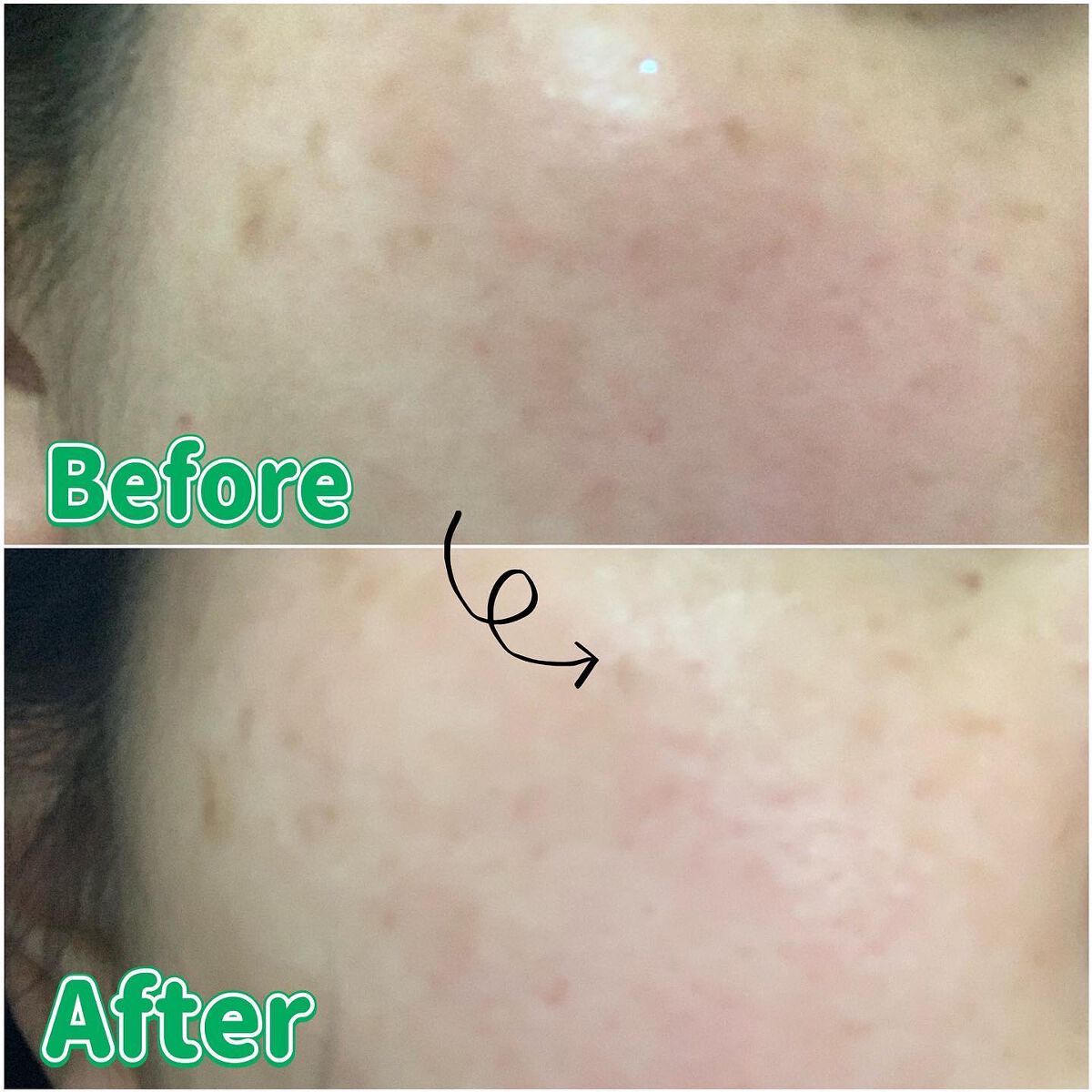 CICA デイリースージングマスク/VT/シートマスク・パックを使ったクチコミ(3枚目)