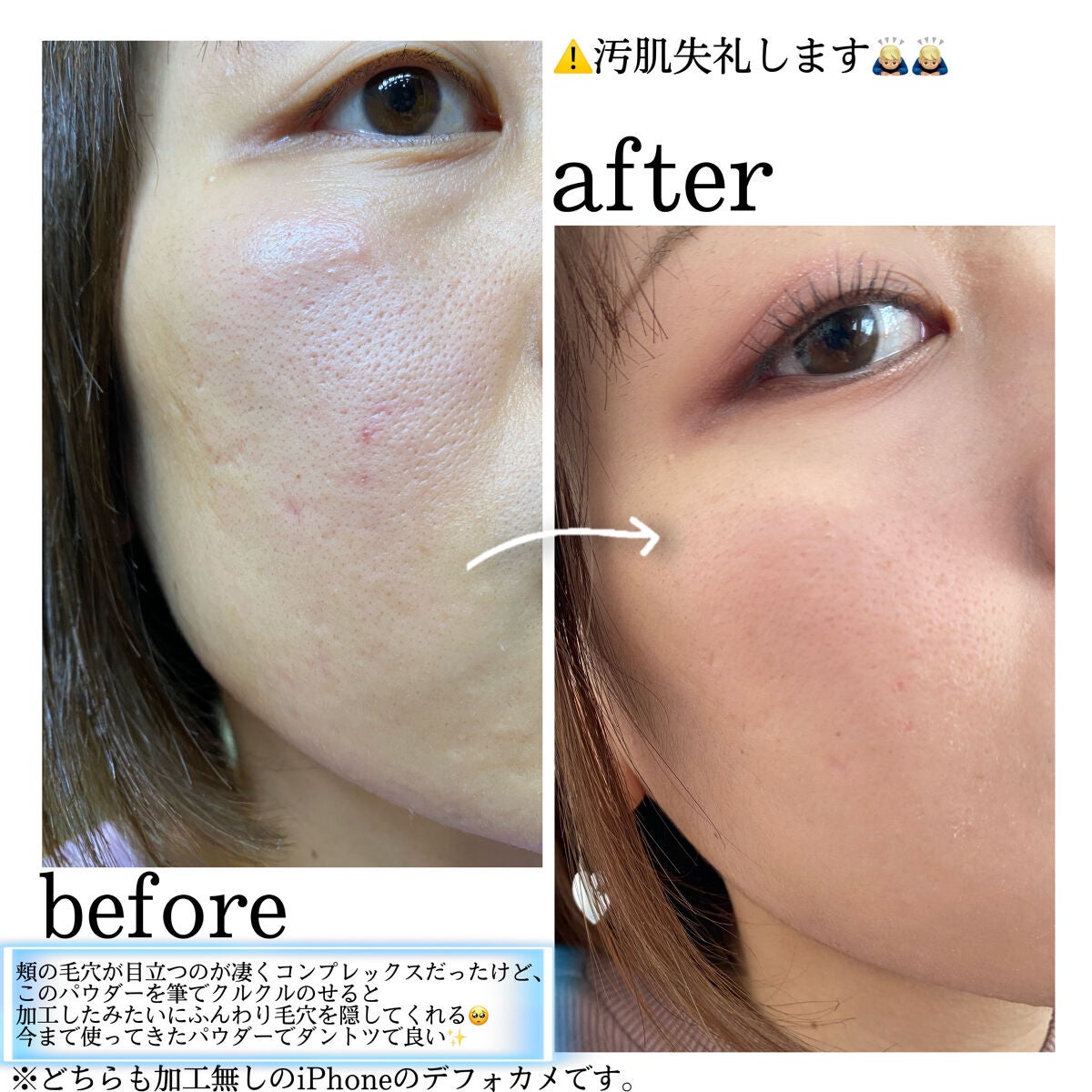 ライトリフレクティングセッティングパウダー ルース N 02383/NARS/ルースパウダーを使ったクチコミ(2枚目)