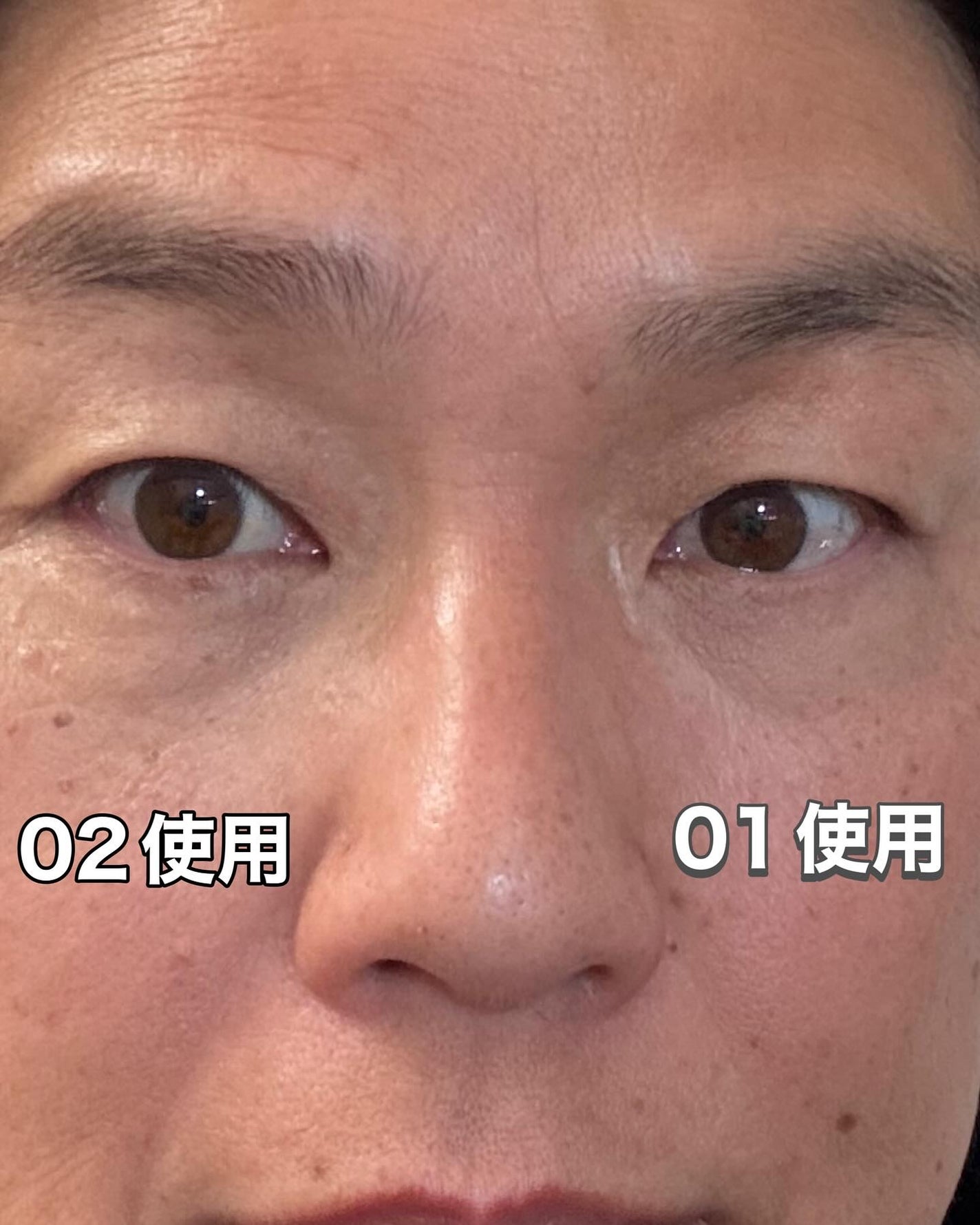 アイレノール クマクリーム/IRENOL/アイケア・アイクリームを使ったクチコミ(6枚目)