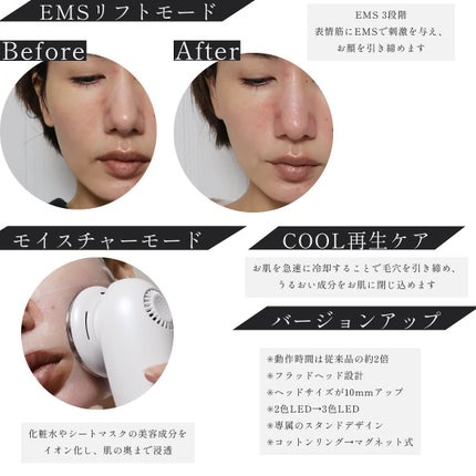 多機能温冷美顔器/ANLAN/美顔器・マッサージを使ったクチコミ(3枚目)