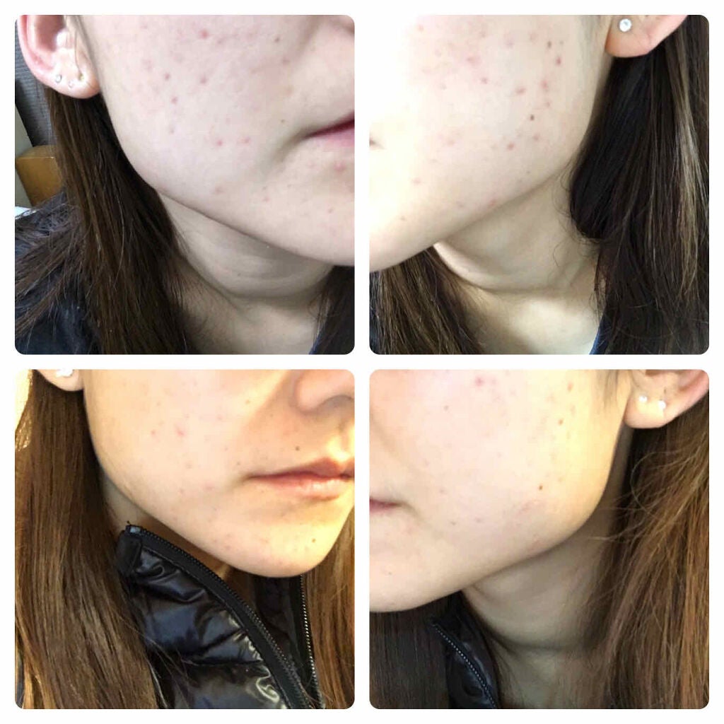 化粧水・敏感肌用・しっとりタイプ/無印良品/化粧水を使ったクチコミ(1枚目)