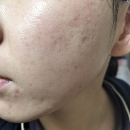 マデカソ 美容液/A’pieu/美容液を使ったクチコミ(2枚目)