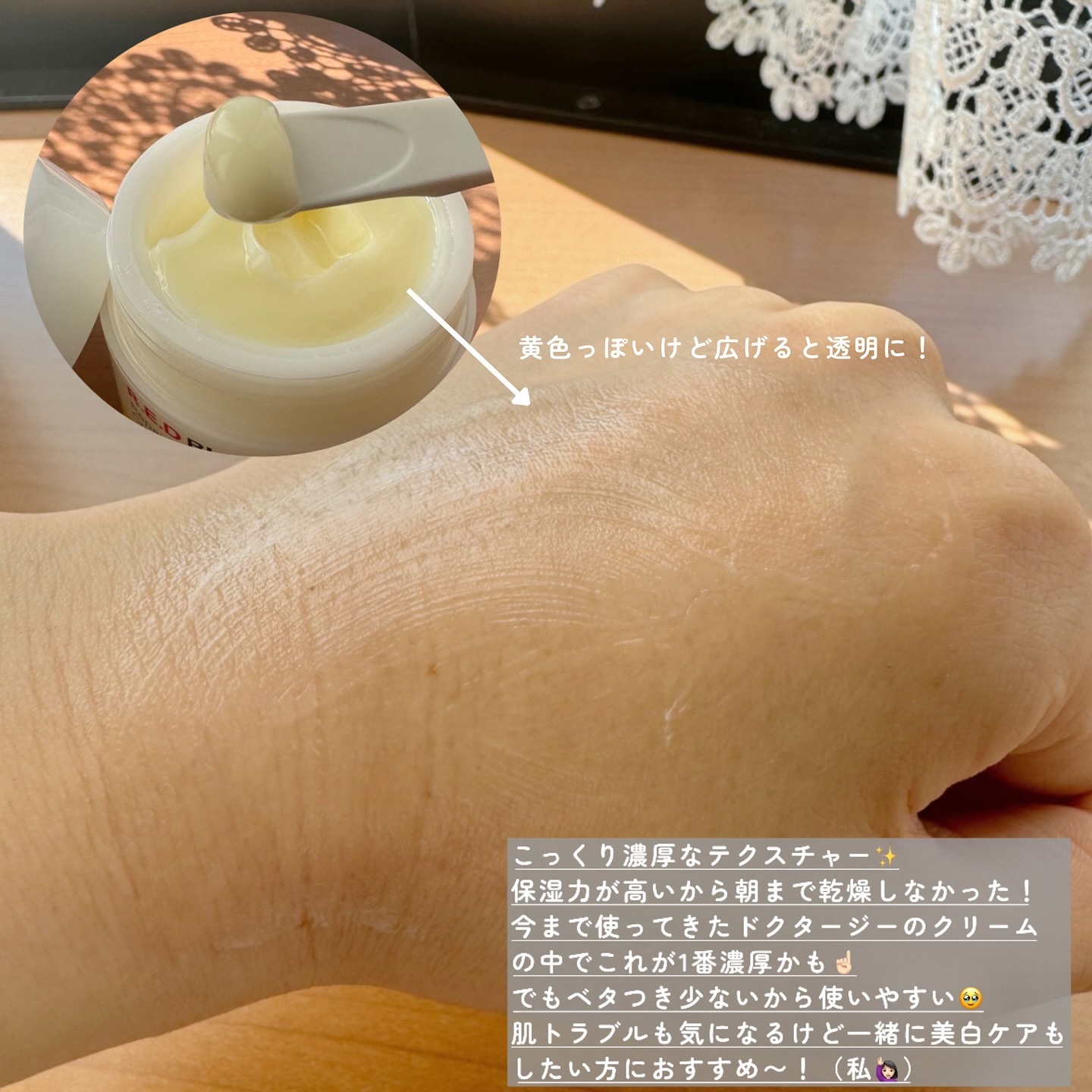 レッドブレミッシュ リペアスージングクリーム/Dr.G/フェイスクリームを使ったクチコミ（3枚目）