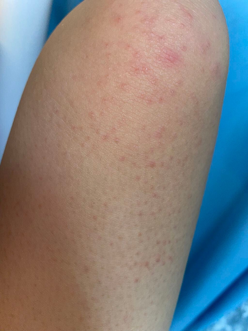 マイルド&モイスチャーアロエジェル/ネイチャーリパブリック/ボディローションを使ったクチコミ(2枚目)