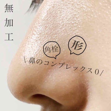 【⚠️2枚目閲覧注意】

白い角栓と丸い鼻先に悩んでました。

白い角栓はホットジェルクレンジングでもとれないし、ピーリングしたりしても残る💧

よくないとわかっているのに、つい爪でガリガリやっちゃった