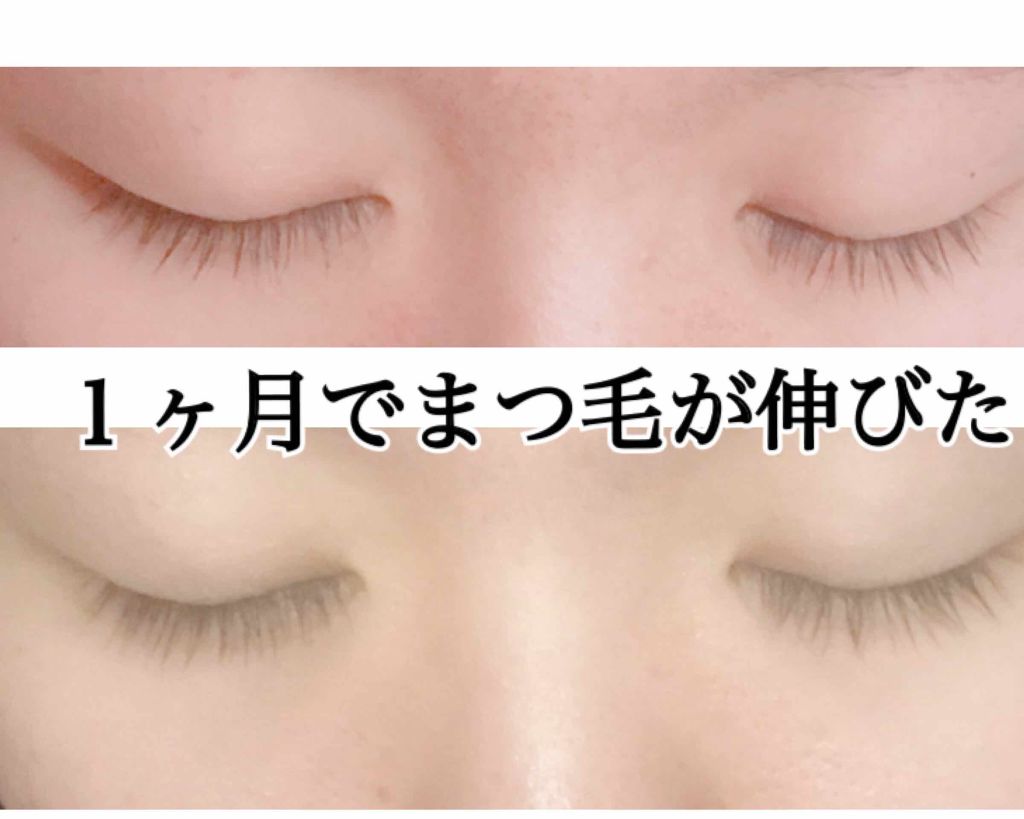 ローヤルゼリー配合 栄養ローション/DAISO/美容液を使ったクチコミ(1枚目)