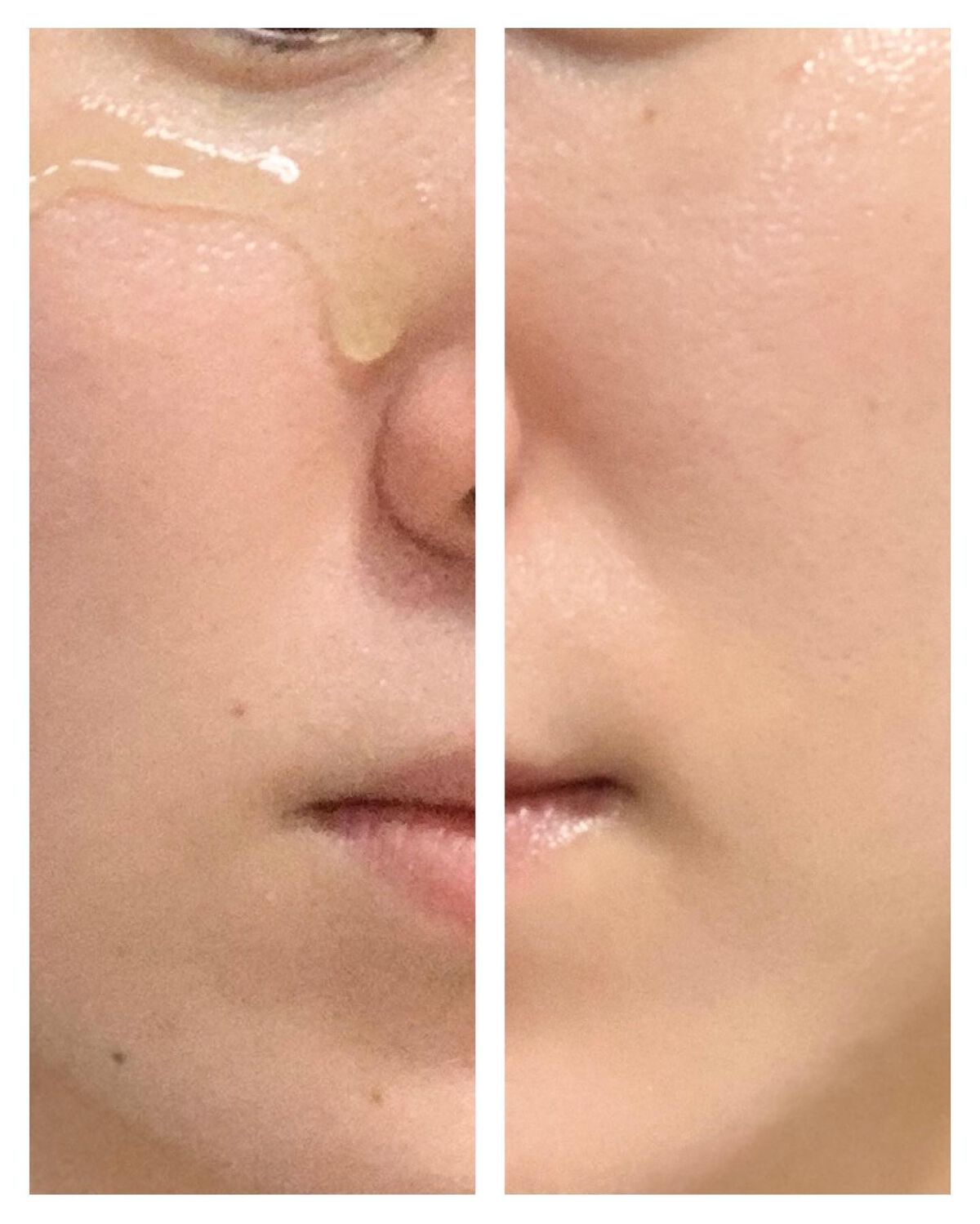 BHA消しゴムピーリングパッド/celimax/トナーパッドを使ったクチコミ(6枚目)