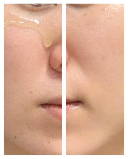 BHA消しゴムピーリングパッド/celimax/トナーパッドを使ったクチコミ(6枚目)