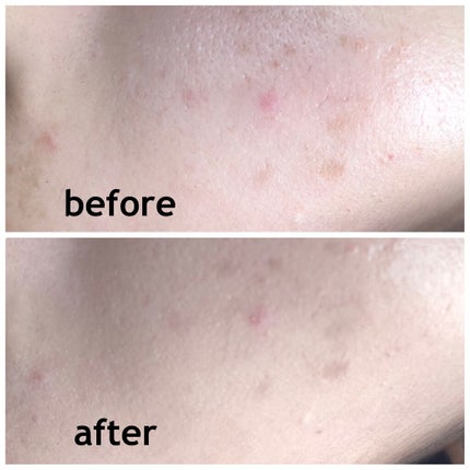 ボタニック サイエンス 薬用 美容液クッションコンパクト/HAKU/クッションファンデーションを使ったクチコミ(3枚目)