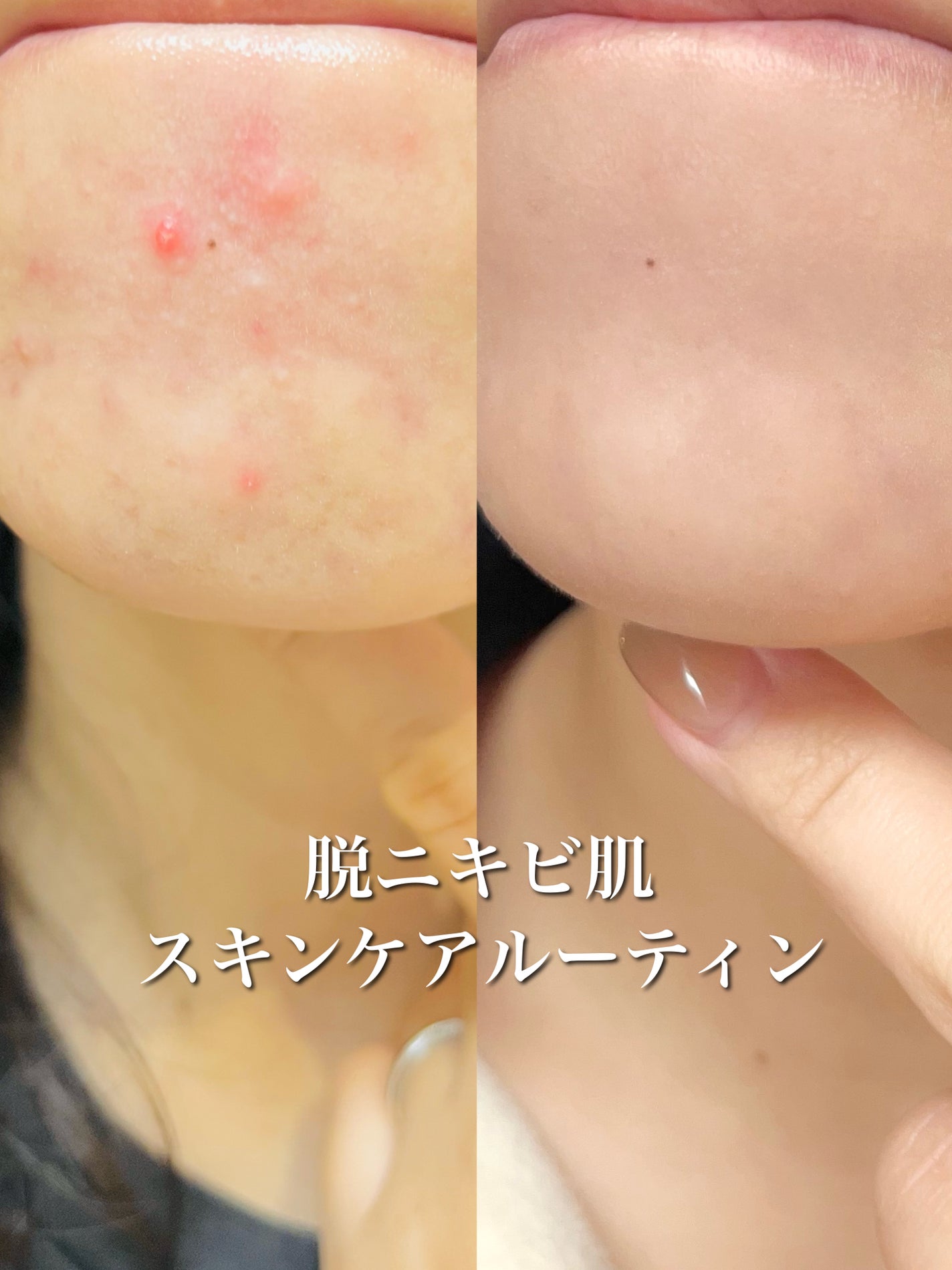 ピュア クレンジング オイル/manyo/オイルクレンジングを使ったクチコミ(1枚目)