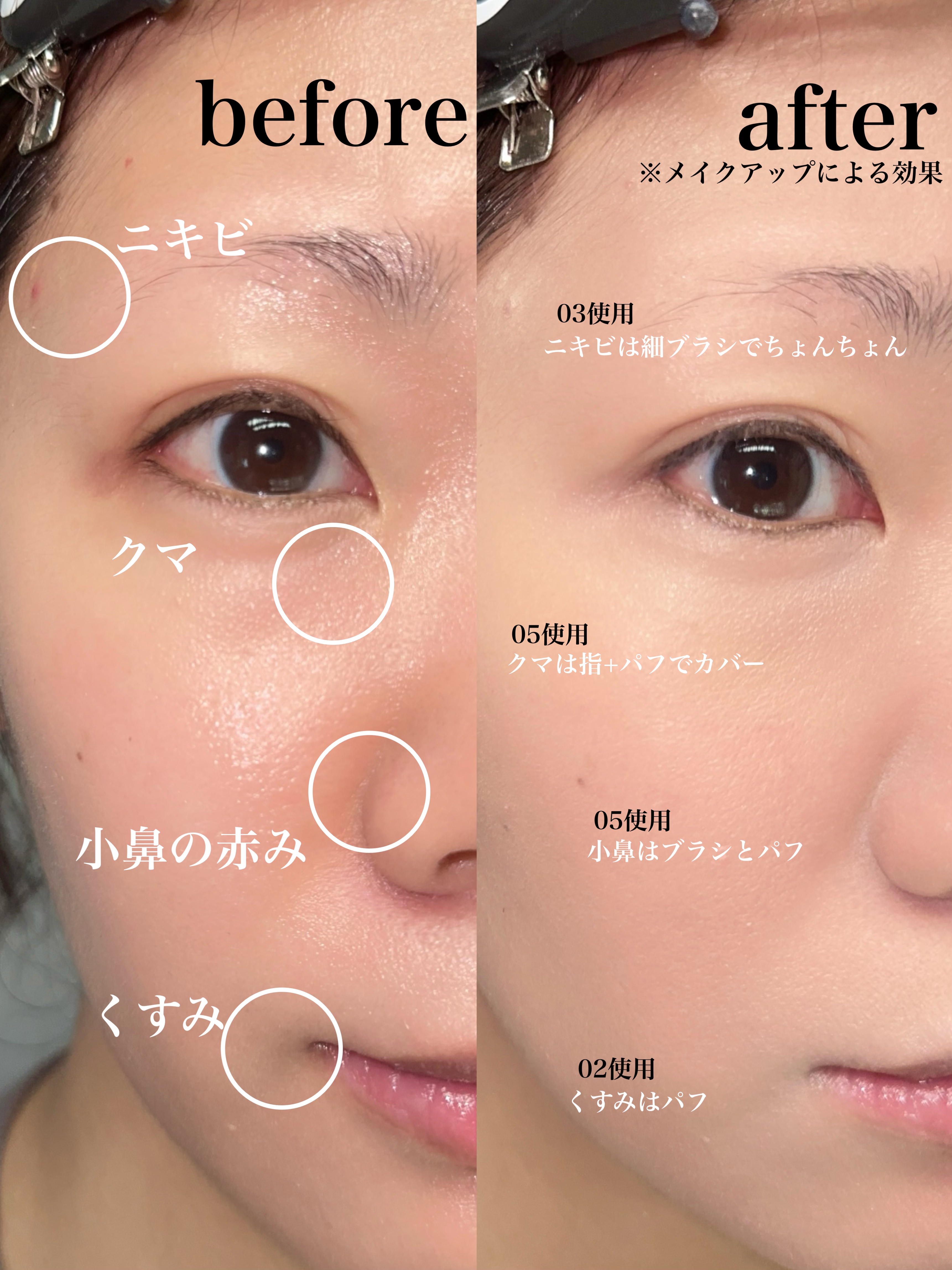 パーソナルシングルコンシーラー/Dear.A/パレットコンシーラーを使ったクチコミ（2枚目）