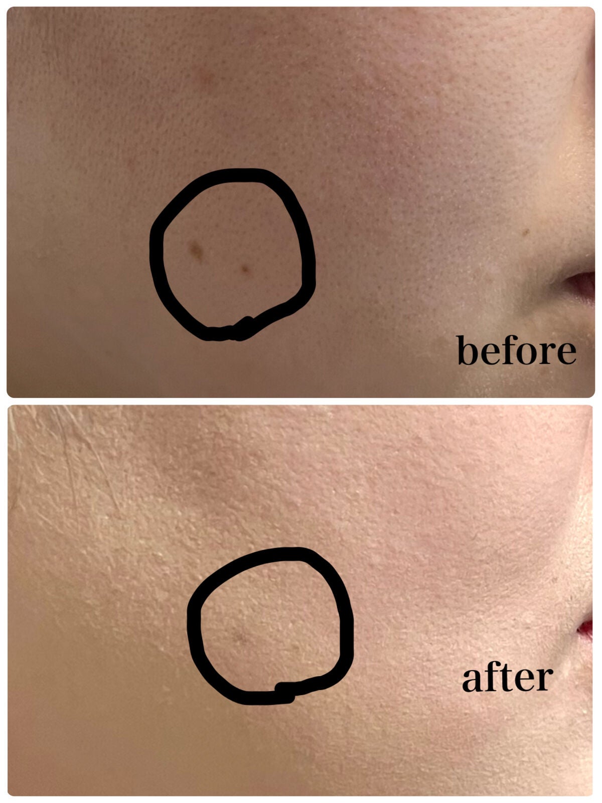 ブラック クッション/HERA/クッションファンデーションを使ったクチコミ(5枚目)