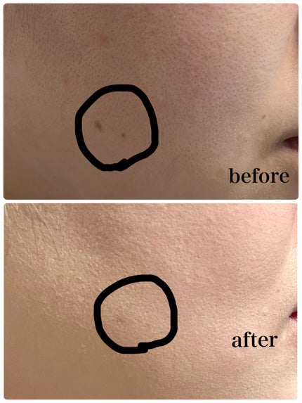 ブラック クッション/HERA/クッションファンデーションを使ったクチコミ(5枚目)