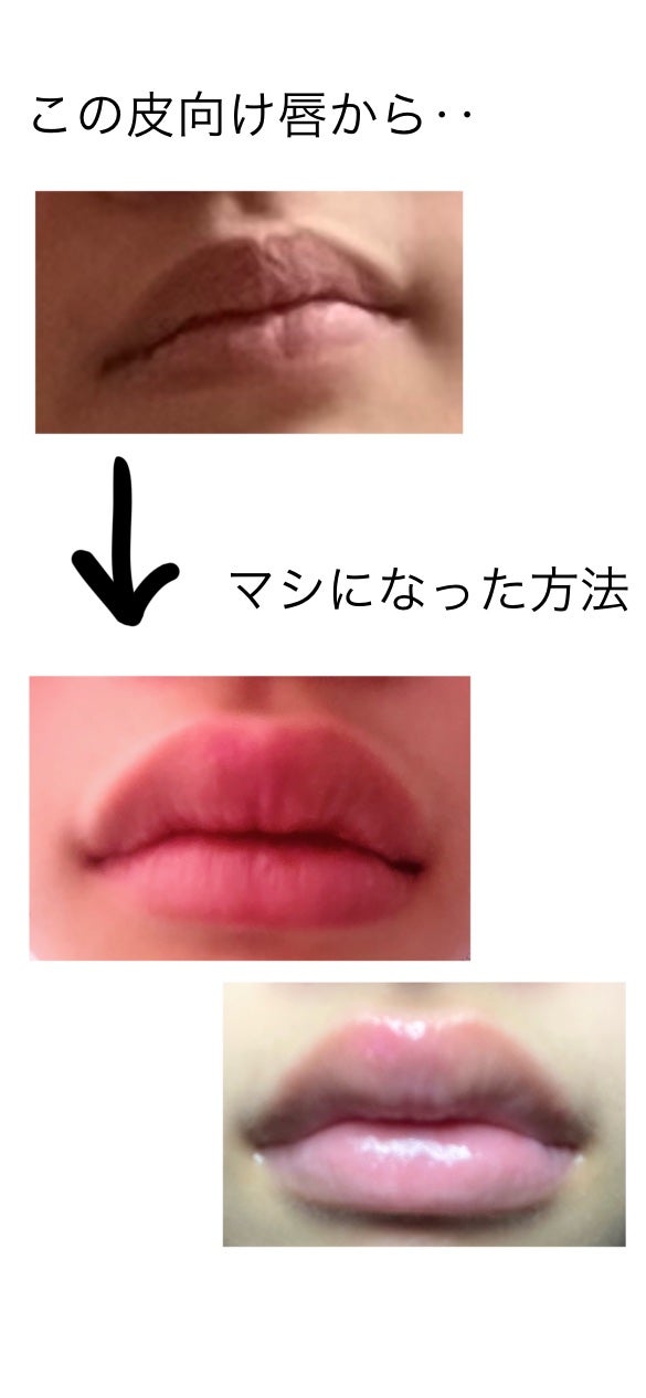 メディカルリップnc(医薬品)/メンソレータム/その他を使ったクチコミ(1枚目)