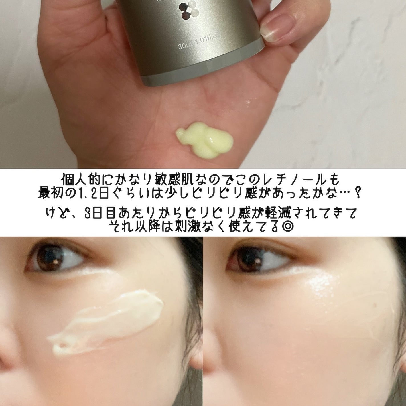 ヴィーガンリポソームレチノールセラム/SKIN&LAB/美容液を使ったクチコミ(4枚目)