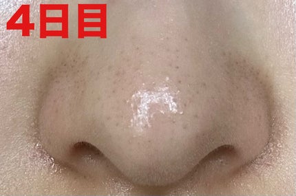 泥ジェル洗顔/ファンケル/その他洗顔料を使ったクチコミ(2枚目)