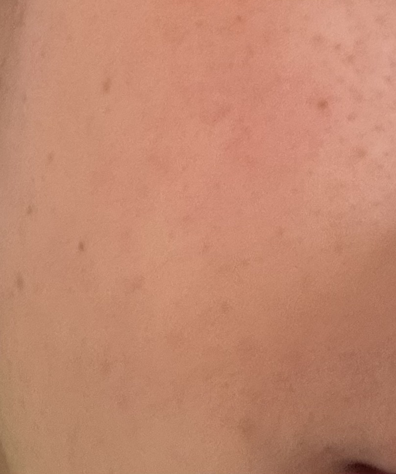 ピュアナチュラルフォーミングウォッシュ/TWANY/泡洗顔を使ったクチコミ（1枚目）