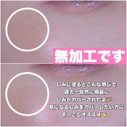 薬用ホワイトニングUVコンシーラー/トランシーノ/スティックコンシーラーを使ったクチコミ(5枚目)