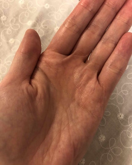 イーブン ベター ブライター エッセンス ローション/CLINIQUE/化粧水を使ったクチコミ(2枚目)