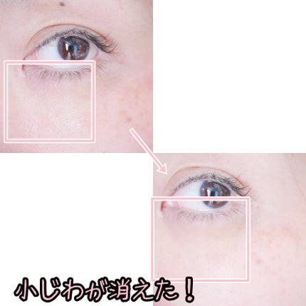 エクストラ ダブルホワイト美容液 Gタイプ/PlusRay/美容液を使ったクチコミ(7枚目)