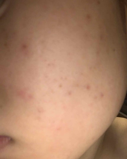 ぴ on LIPS 「6月でキュレルの化粧水を使い終わりました!なんとなく良くなって..」(2枚目)