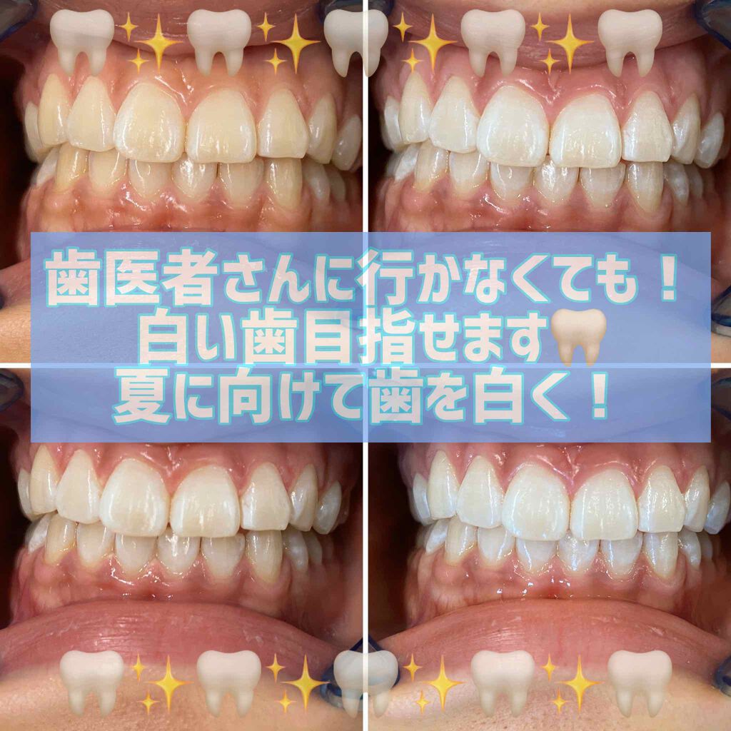 whitening salon crew 柏 on LIPS 「コロナで色々な楽しい事が中止になりますよね😭だからこそ!もう夏..」(1枚目)