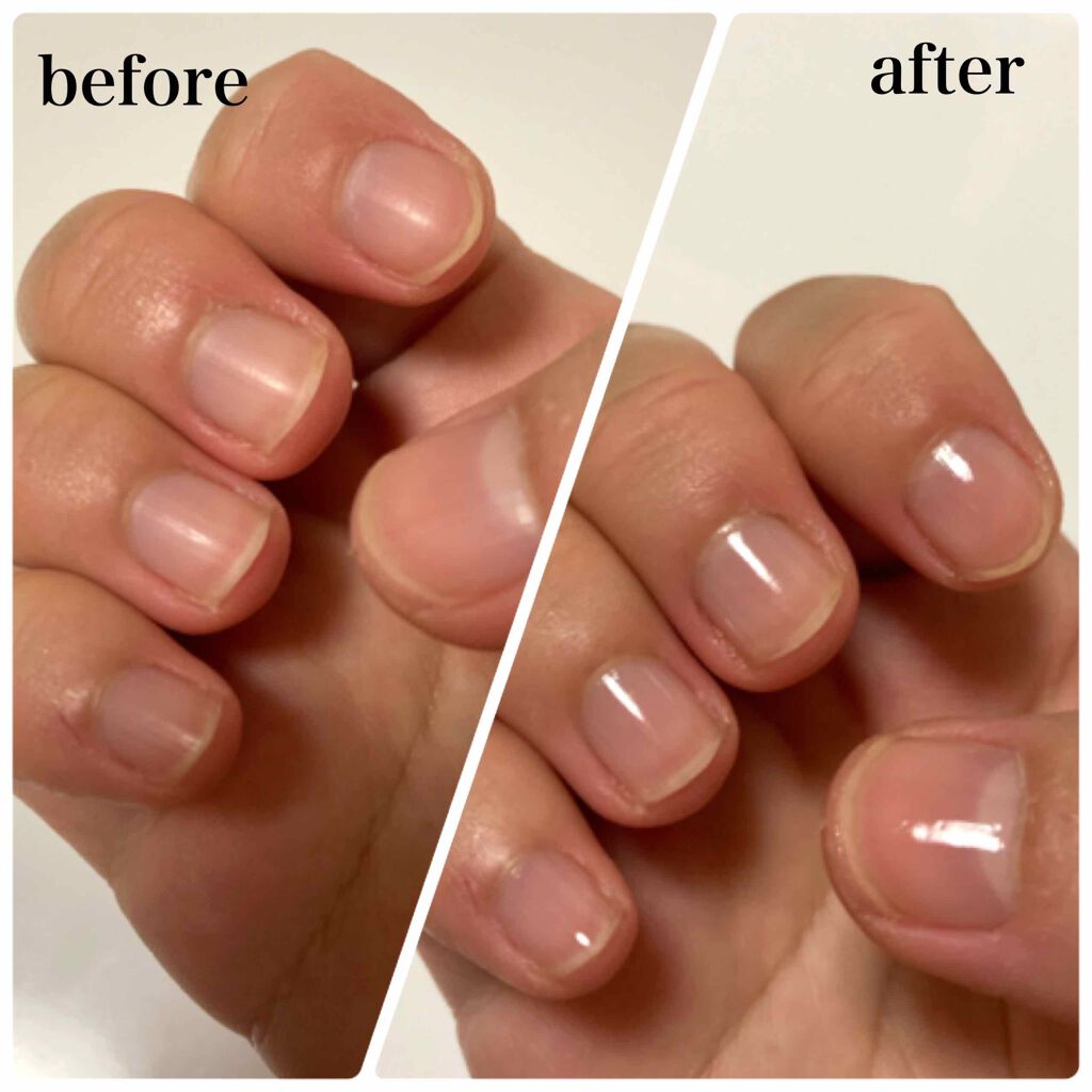 ウォータリーネイルジェル クイックグロス		/D-UP/オールインワンネイルを使ったクチコミ（3枚目）